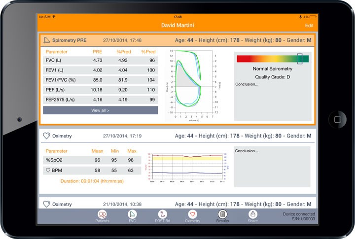 ΣΠΙΡΟΜΕΤΡΟ SPIROBANK II SMART